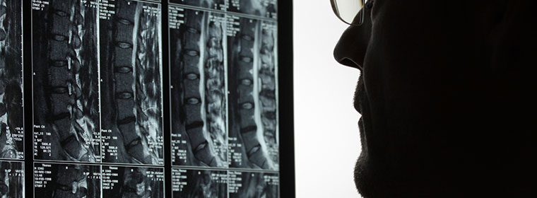 A doctor examining an epidural abscess