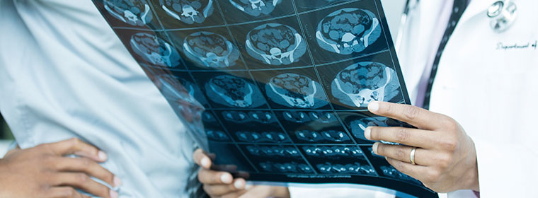A radiologist misreading an imaging study