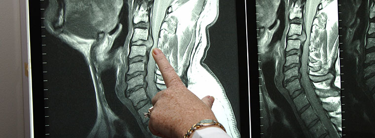A physician examining a spinal cord injury